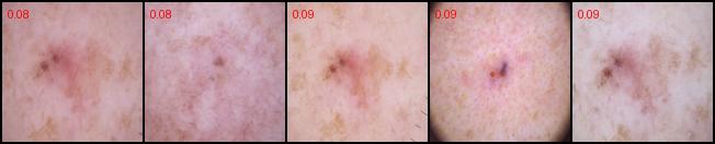 BCC-P01