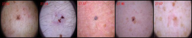 BCC-P04
