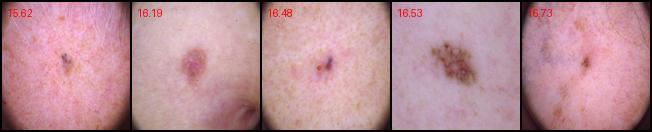 BCC-P09