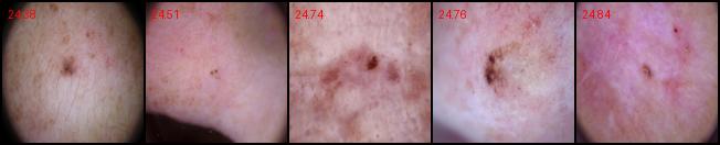 BCC-P15
